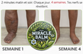 Miracle Balm